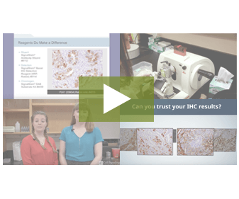 19-IMM-52680-ich-resource-landing-page-image 19-IMM-52680-ich-resource-landing-page-image